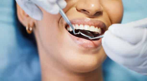 Best Emergency Dentist for Lost Fillings or Crowns in Malta, IL